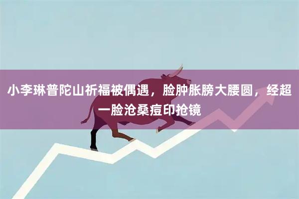 小李琳普陀山祈福被偶遇，脸肿胀膀大腰圆，经超一脸沧桑痘印抢镜